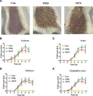 Serum Metabolomic Profiling Reveals the Amelioration Effect of Methotrexate on Imiquimod-Induced Psoriasis in Mouse